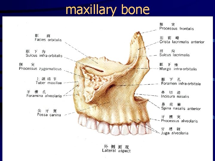 maxillary bone 
