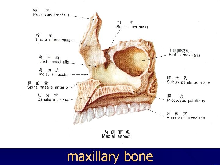 maxillary bone 