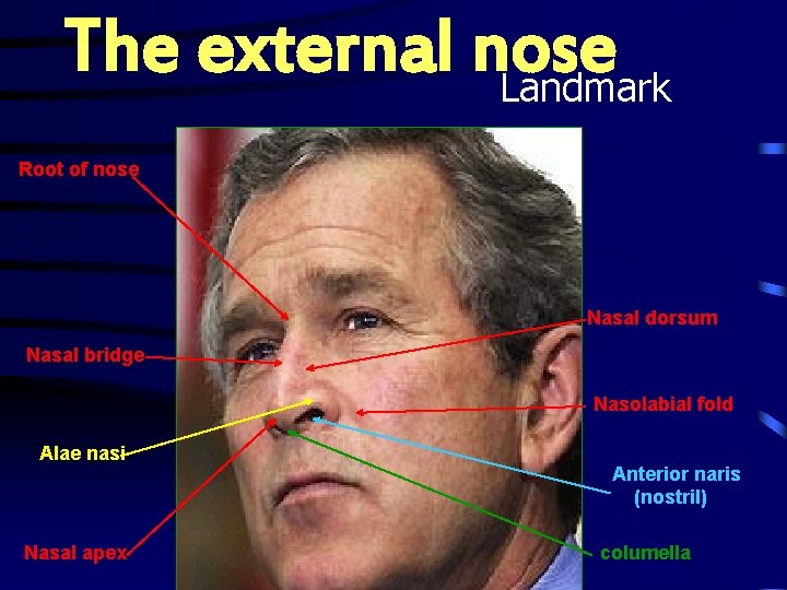 The external nose Landmark Root of nose Nasal dorsum Nasal bridge Nasolabial fold Alae