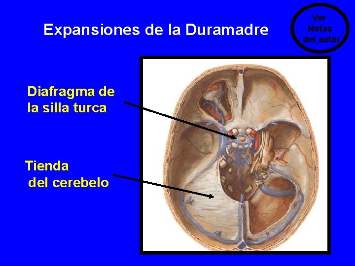 Expansiones de la Duramadre Diafragma de la silla turca Tienda del cerebelo Ver Notas Expansiones de la Duramadre Diafragma de la silla turca Tienda del cerebelo Ver Notas
