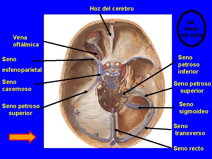 Hoz del cerebro Vena oftálmica Seno esfenoparietal Seno cavernoso Seno petroso superior Ver Notas Hoz del cerebro Vena oftálmica Seno esfenoparietal Seno cavernoso Seno petroso superior Ver Notas