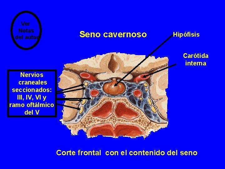 TEMA II Sistema Nervioso Meninges Vascularizacin Y Lquido