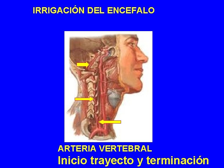IRRIGACIÓN DEL ENCEFALO ARTERIA VERTEBRAL Inicio trayecto y terminación IRRIGACIÓN DEL ENCEFALO ARTERIA VERTEBRAL Inicio trayecto y terminación