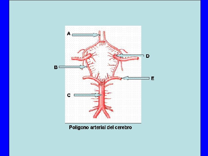 En el “Polígono arterial del Cerebro” asientan múltiples aneurismas (dilataciones de la pared de En el “Polígono arterial del Cerebro” asientan múltiples aneurismas (dilataciones de la pared de