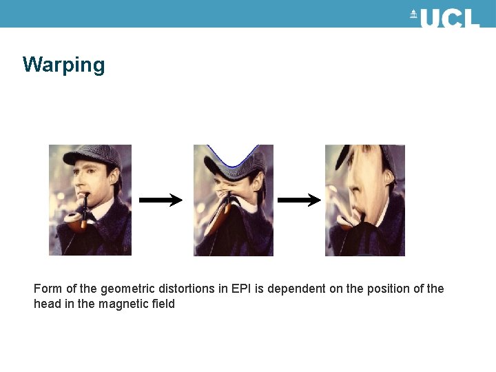 Warping Form of the geometric distortions in EPI is dependent on the position of Warping Form of the geometric distortions in EPI is dependent on the position of