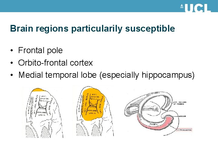 Brain regions particularily susceptible • Frontal pole • Orbito-frontal cortex • Medial temporal lobe Brain regions particularily susceptible • Frontal pole • Orbito-frontal cortex • Medial temporal lobe