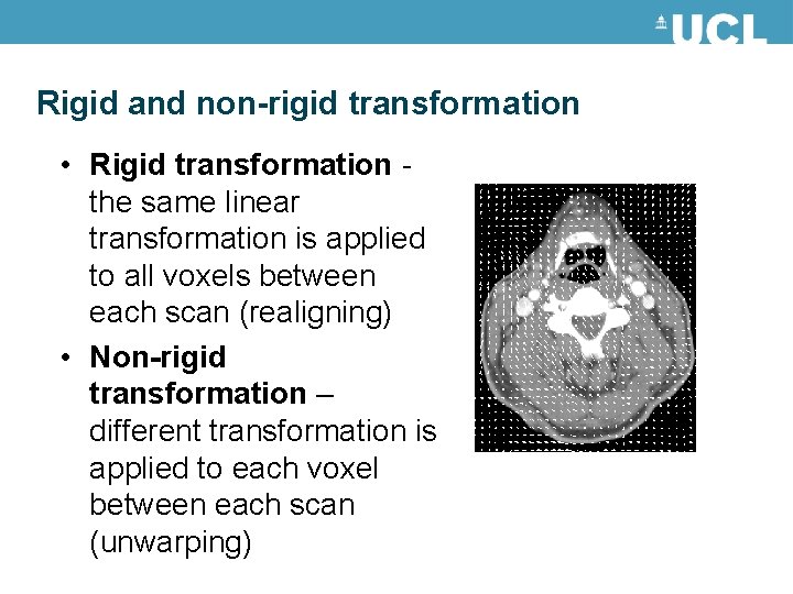 Rigid and non-rigid transformation • Rigid transformation - the same linear transformation is applied Rigid and non-rigid transformation • Rigid transformation - the same linear transformation is applied