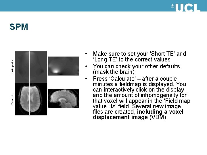 SPM • Make sure to set your ‘Short TE’ and ‘Long TE’ to the SPM • Make sure to set your ‘Short TE’ and ‘Long TE’ to the
