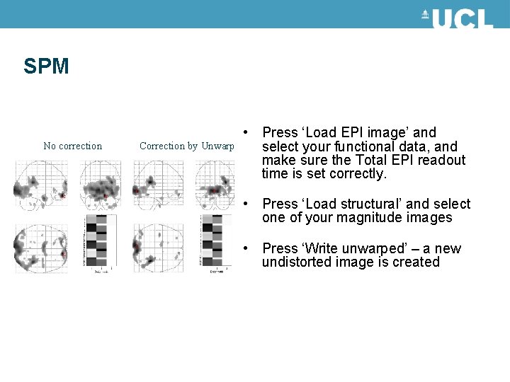 SPM No correction Correction by Unwarp • Press ‘Load EPI image’ and select your SPM No correction Correction by Unwarp • Press ‘Load EPI image’ and select your