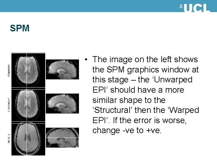 SPM • The image on the left shows the SPM graphics window at this SPM • The image on the left shows the SPM graphics window at this