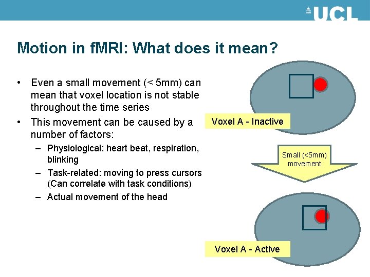 Motion in f. MRI: What does it mean? • Even a small movement (< Motion in f. MRI: What does it mean? • Even a small movement (<
