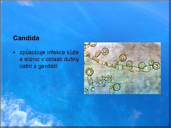 Candida • způsobuje infekce kůže a sliznic v oblasti dutiny ústní a genitálií 