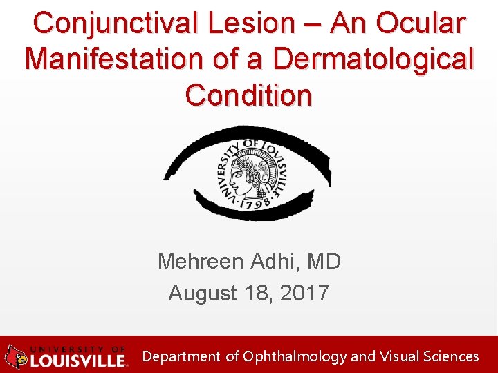 Conjunctival Lesion – An Ocular Manifestation of a Dermatological Condition Mehreen Adhi, MD August