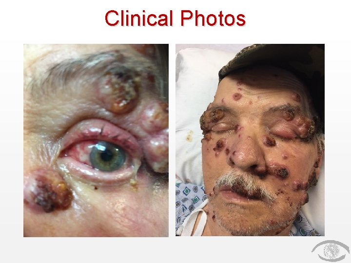 Clinical Photos 