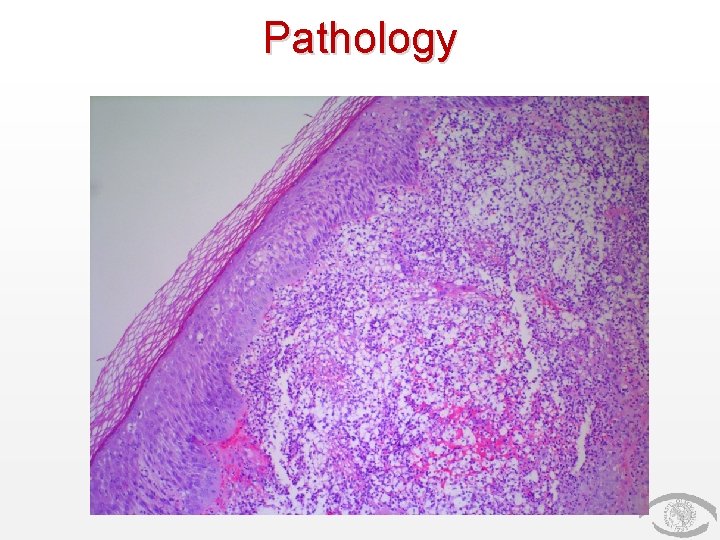 Pathology 