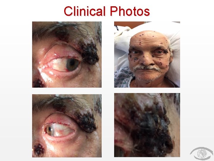 Clinical Photos 