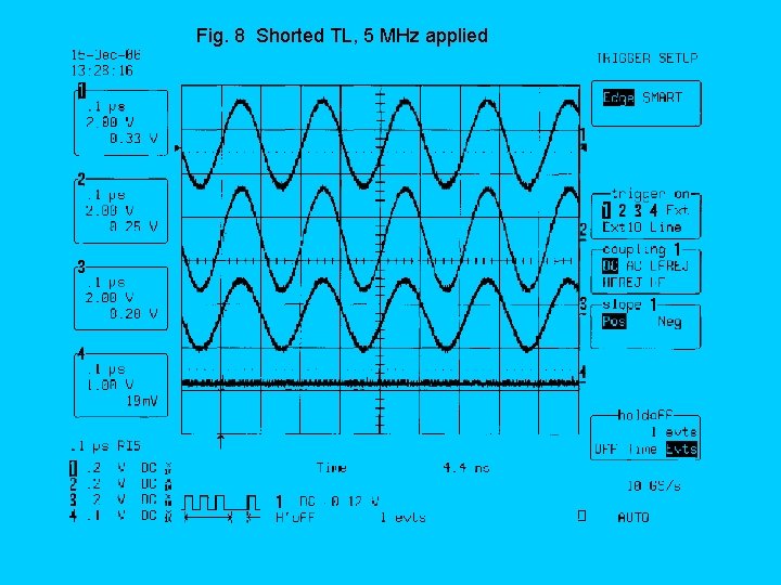 Fig. 8 Shorted TL, 5 MHz applied 