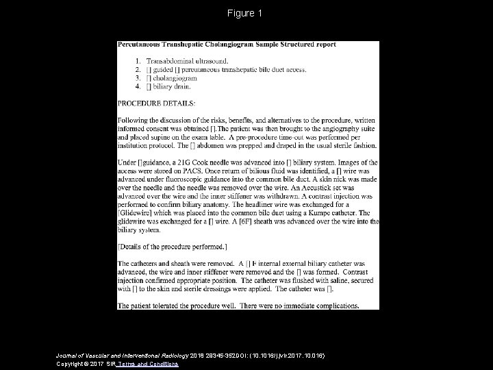 Figure 1 Journal of Vascular and Interventional Radiology 2018 29345 -352 DOI: (10. 1016/j.