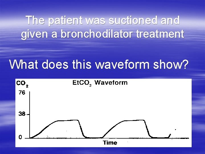 The patient was suctioned and given a bronchodilator treatment What does this waveform show? The patient was suctioned and given a bronchodilator treatment What does this waveform show?