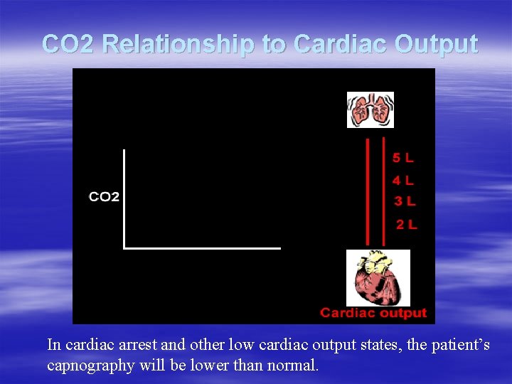 CO 2 Relationship to Cardiac Output In cardiac arrest and other low cardiac output CO 2 Relationship to Cardiac Output In cardiac arrest and other low cardiac output