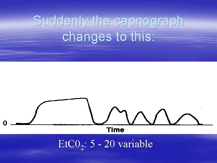 Suddenly the capnograph changes to this: Et. C 02: 5 - 20 variable Suddenly the capnograph changes to this: Et. C 02: 5 - 20 variable