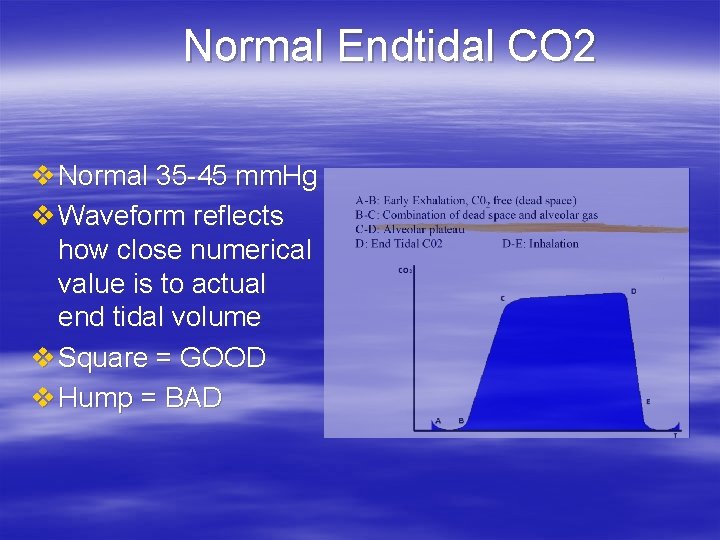 Normal Endtidal CO 2 v Normal 35 -45 mm. Hg v Waveform reflects how Normal Endtidal CO 2 v Normal 35 -45 mm. Hg v Waveform reflects how
