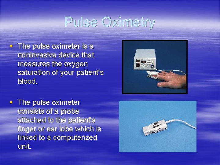 Pulse Oximetry § The pulse oximeter is a noninvasive device that measures the oxygen Pulse Oximetry § The pulse oximeter is a noninvasive device that measures the oxygen