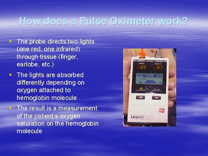 How does a Pulse Oximeter work? § The probe directs two lights (one red, How does a Pulse Oximeter work? § The probe directs two lights (one red,