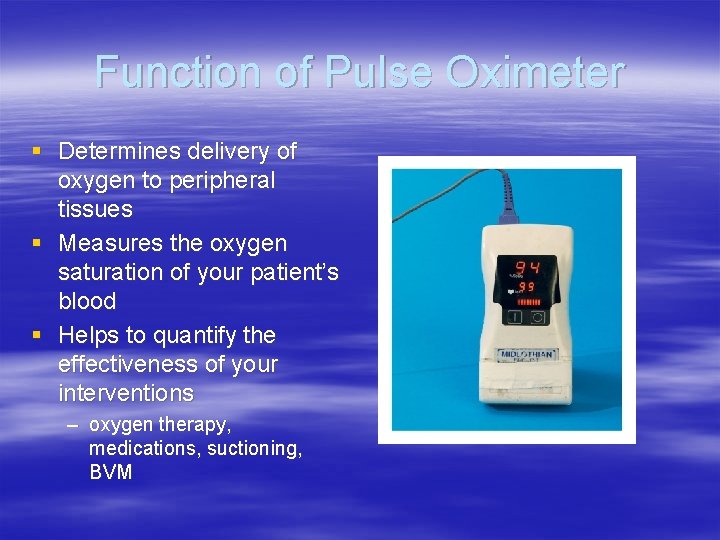 Function of Pulse Oximeter § Determines delivery of oxygen to peripheral tissues § Measures Function of Pulse Oximeter § Determines delivery of oxygen to peripheral tissues § Measures