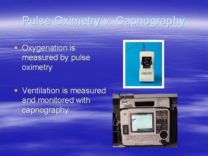 Pulse Oximetry v. Capnography § Oxygenation is measured by pulse oximetry § Ventilation is Pulse Oximetry v. Capnography § Oxygenation is measured by pulse oximetry § Ventilation is