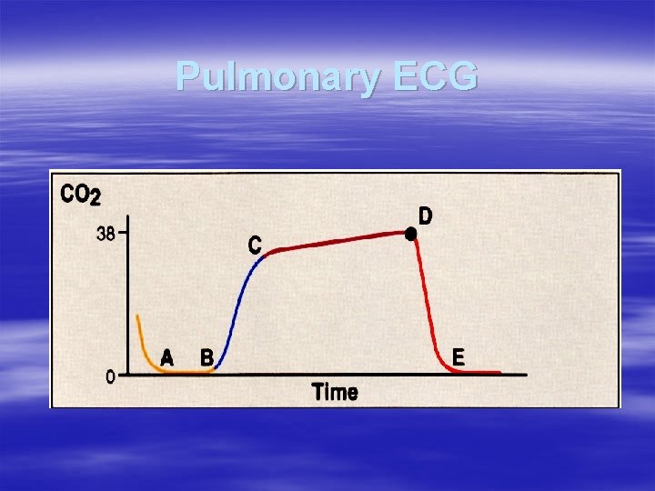 Pulmonary ECG Pulmonary ECG