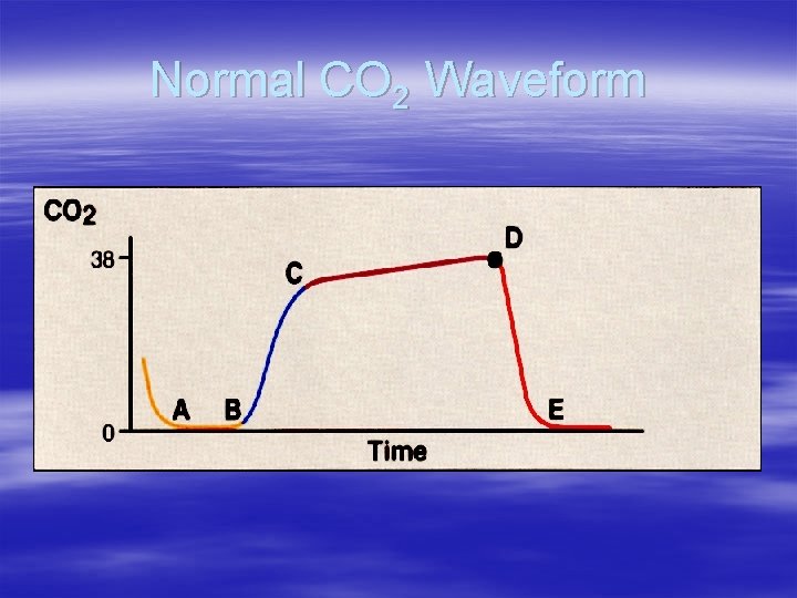 Normal CO 2 Waveform Normal CO 2 Waveform