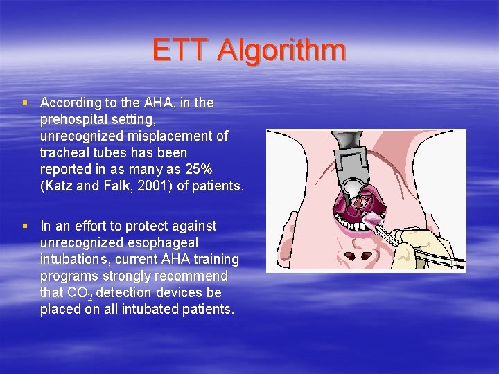 ETT Algorithm § According to the AHA, in the prehospital setting, unrecognized misplacement of ETT Algorithm § According to the AHA, in the prehospital setting, unrecognized misplacement of