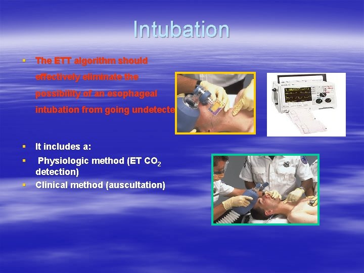 Intubation § The ETT algorithm should effectively eliminate the possibility of an esophageal intubation Intubation § The ETT algorithm should effectively eliminate the possibility of an esophageal intubation