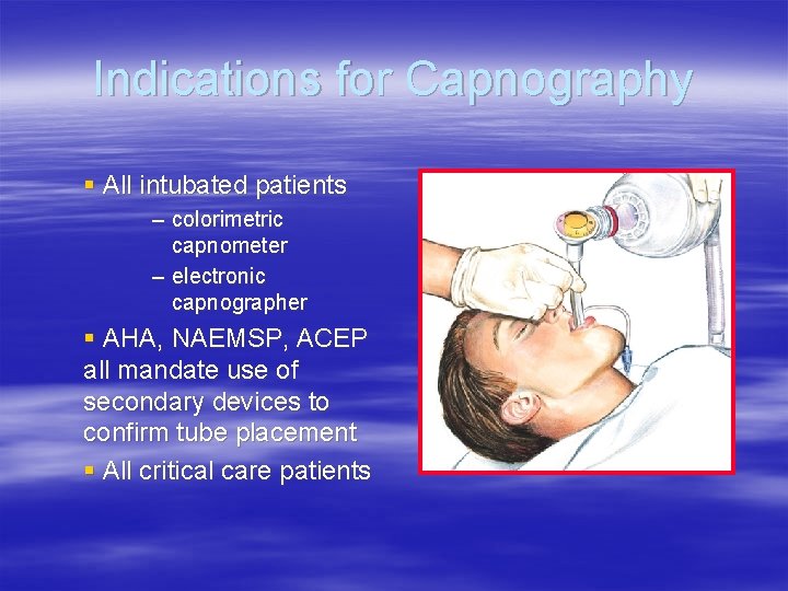 Indications for Capnography § All intubated patients – colorimetric capnometer – electronic capnographer § Indications for Capnography § All intubated patients – colorimetric capnometer – electronic capnographer §