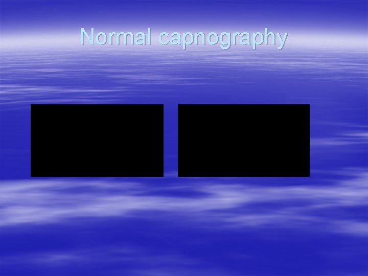 Normal capnography Normal capnography