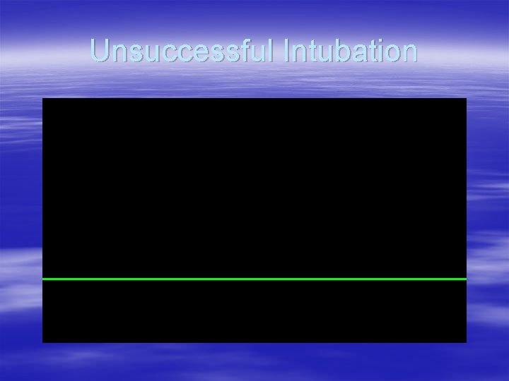 Unsuccessful Intubation Unsuccessful Intubation