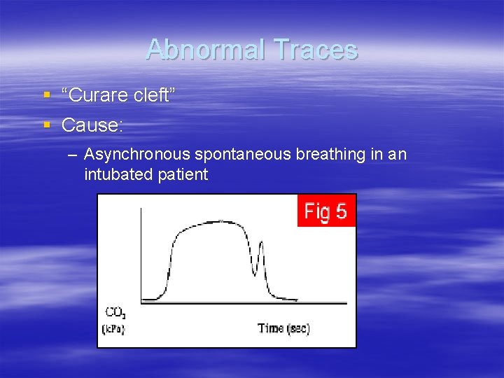 Abnormal Traces § “Curare cleft” § Cause: – Asynchronous spontaneous breathing in an intubated Abnormal Traces § “Curare cleft” § Cause: – Asynchronous spontaneous breathing in an intubated
