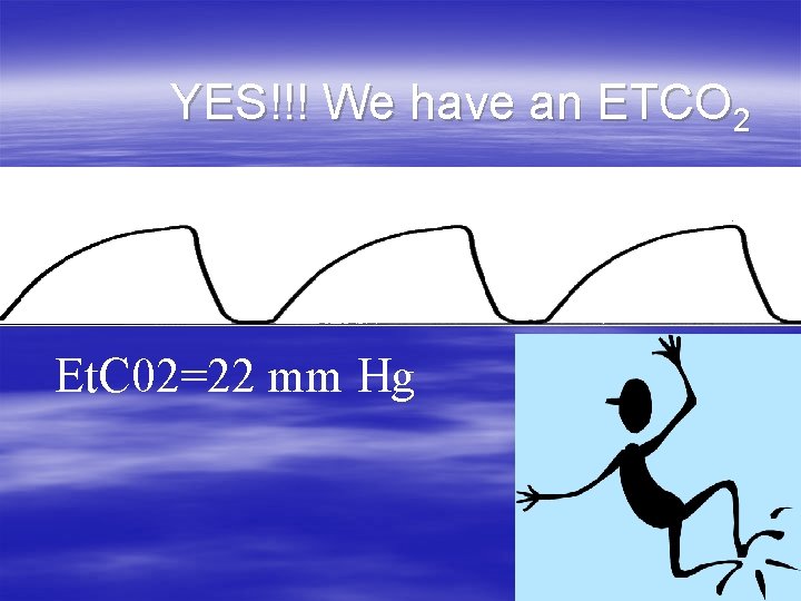 YES!!! We have an ETCO 2 Et. C 02=22 mm Hg YES!!! We have an ETCO 2 Et. C 02=22 mm Hg