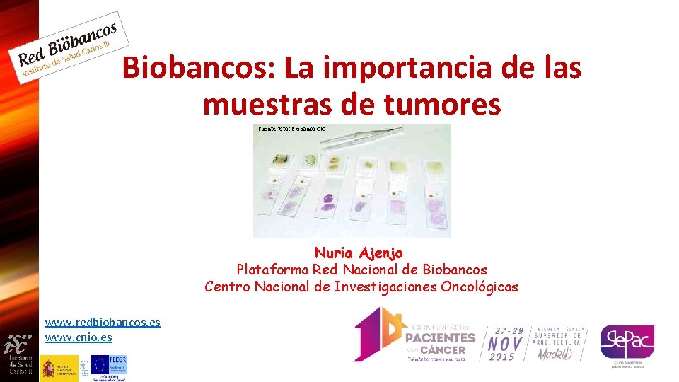 Biobancos: La importancia de las muestras de tumores Fuente foto: Biobanco CIC Nuria Ajenjo