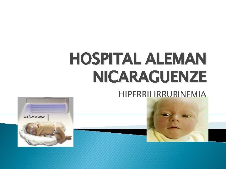 HOSPITAL ALEMAN NICARAGUENZE HIPERBILIRRUBINEMIA 