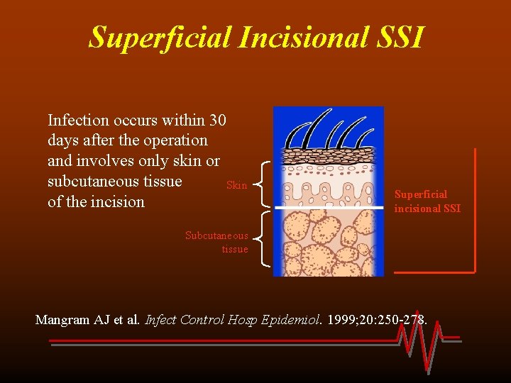 Superficial Incisional SSI Infection occurs within 30 days after the operation and involves only