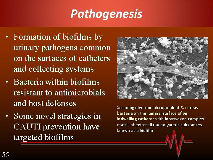 Pathogenesis • Formation of biofilms by urinary pathogens common on the surfaces of catheters