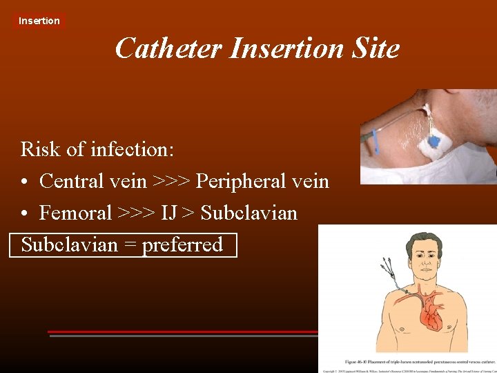 Insertion Catheter Insertion Site Risk of infection: • Central vein >>> Peripheral vein •