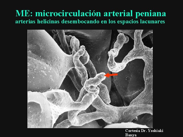 ME: microcirculación arterial peniana arterias helicinas desembocando en los espacios lacunares Cortesia Dr. Yoshiaki