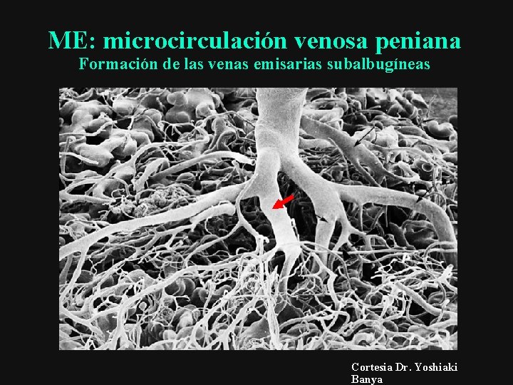 ME: microcirculación venosa peniana Formación de las venas emisarias subalbugíneas Cortesia Dr. Yoshiaki Banya