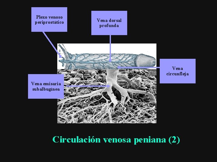 Plexo venoso periprostático Vena dorsal profunda Vena circunfleja Vena emisaria subalbugínea Circulación venosa peniana
