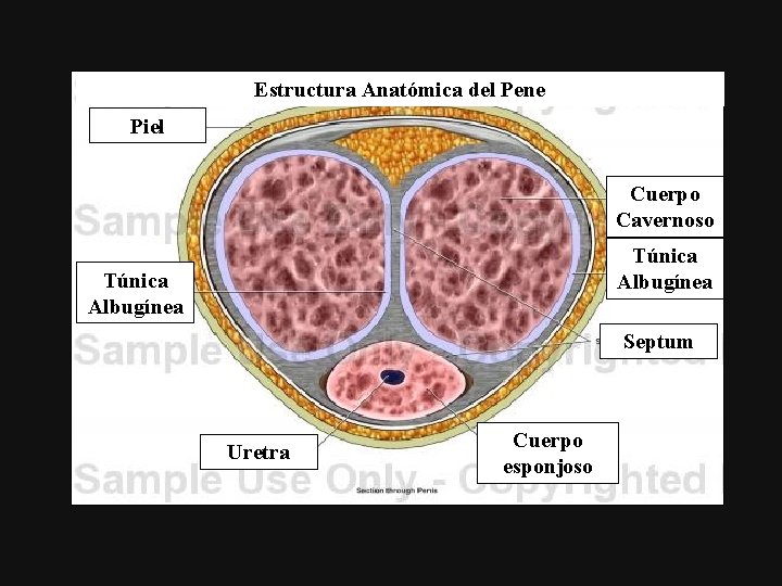 Estructura Anatómica del Pene Piel Cuerpo Cavernoso Túnica Albugínea Septum Uretra Cuerpo esponjoso 