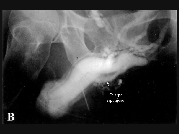 Cuerpo esponjoso 