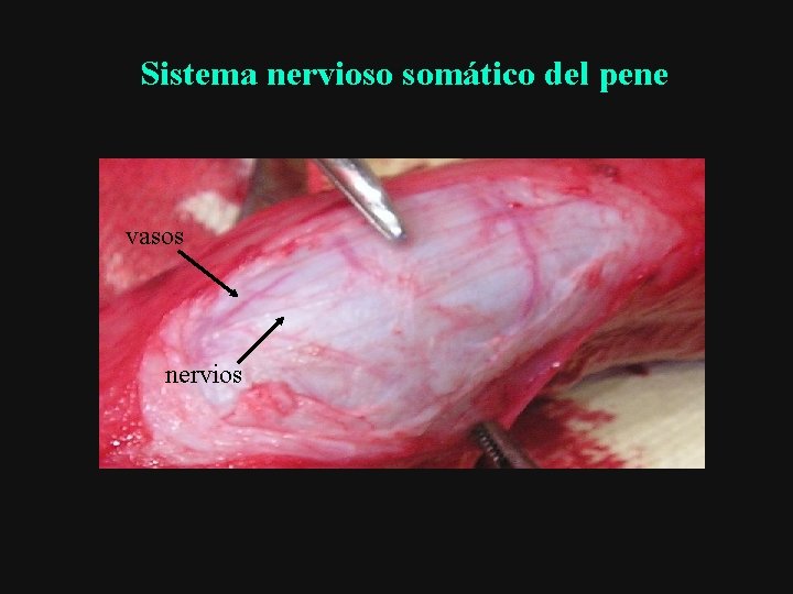 Sistema nervioso somático del pene vasos NERVIO DORSAL nervios 